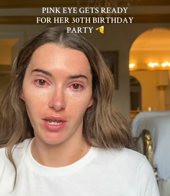 Woman with red, irritated eyes speaking indoors, highlighting influencer criticized for partying with contagious infection. Woman with red, irritated eyes speaking indoors, highlighting influencer criticized for partying with contagious infection.