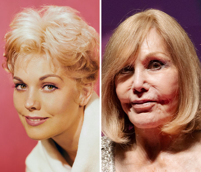 Side-by-side comparison of a celebrity transformation showing aging effects illustrating celebrity transformations in 2025.