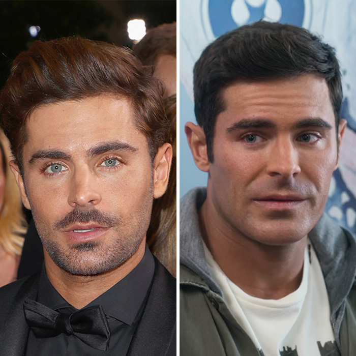 Zac Efron with contrasting facial appearances, highlighting changes discussed by experts regarding his back to normal face.
