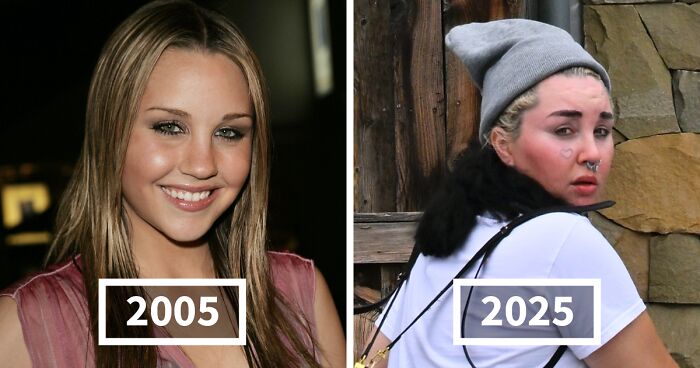 25 Then And Now Shots Of Stars In 2005, 2015 And 2025, Including One Who Was Left “Disfigured”
