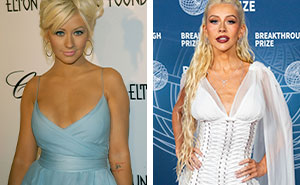 18 fotos de “Antes y después” de celebridades entre 2005, 2015 y 2025, incluyendo a una que quedó “desfigurada”