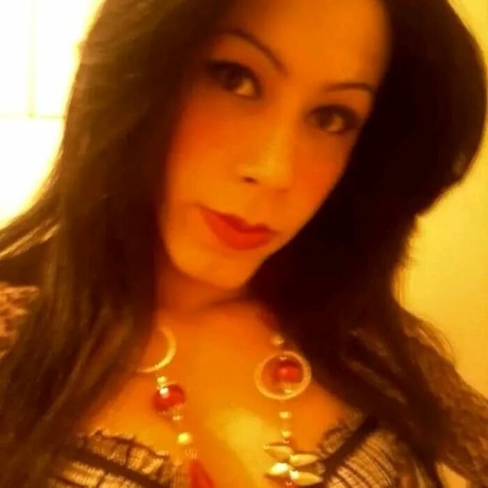 Woman influencer with long dark hair and makeup, highlighting recovery after botched plastic surgery operation.