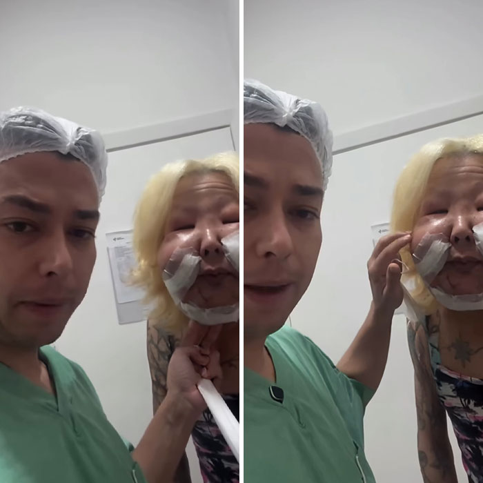 Surgeon in green scrubs with influencer whose face is bandaged after botched plastic surgery undergoing new operation.