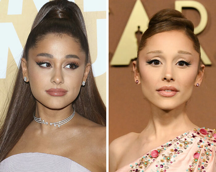 Side-by-side before-and-after shots of Ariana Grande sparking rumors about specific type of plastic surgery.
