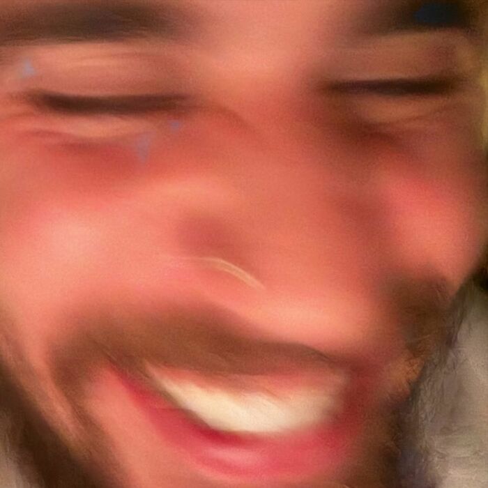 Close-up of a smiling man with a blurred face, highlighting concern for Justin Bieber fans over a noticeable c****h area. Close-up of a smiling man with a blurred face, highlighting concern for Justin Bieber fans over a noticeable c****h area.