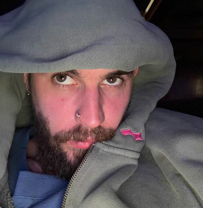 Justin Bieber wearing a hooded jacket, close-up of his face with fans expressing concern after noticing something unusual. Justin Bieber wearing a hooded jacket, close-up of his face with fans expressing concern after noticing something unusual.