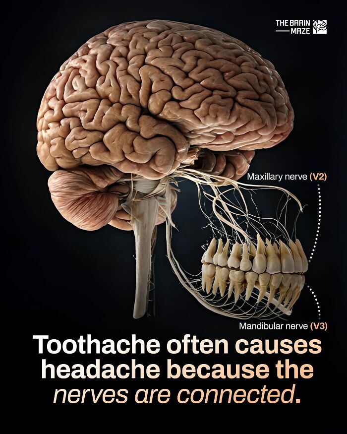 Human body illustration showing brain, nerves, and teeth with text about toothache causing headache due to connected nerves.