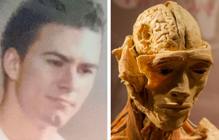 Side-by-side images showing a young man&rsquo;s photo and a skinned human body display in a Las Vegas museum.