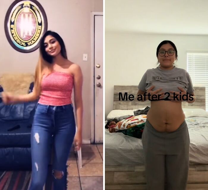 Before and after photos of a mom showing honest and relatable changes after having kids, highlighting motherhood reality.