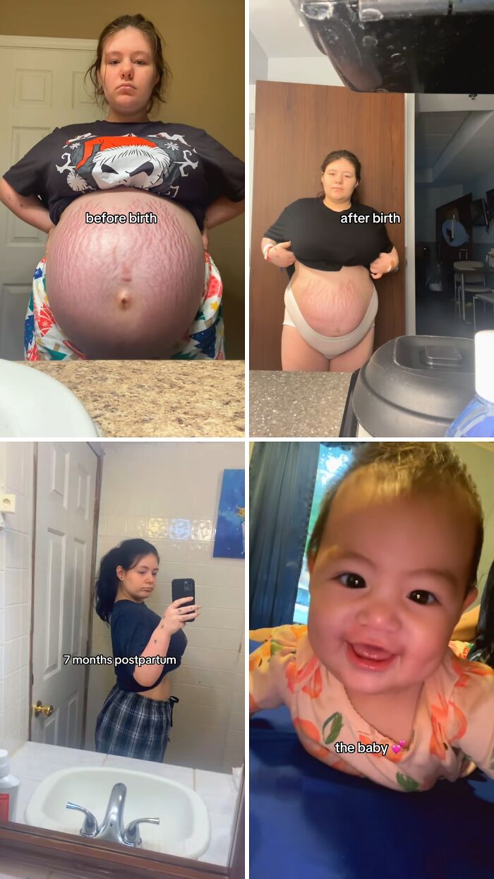 Collage of moms showing before birth, after birth, postpartum changes, and their babies in relatable photos.