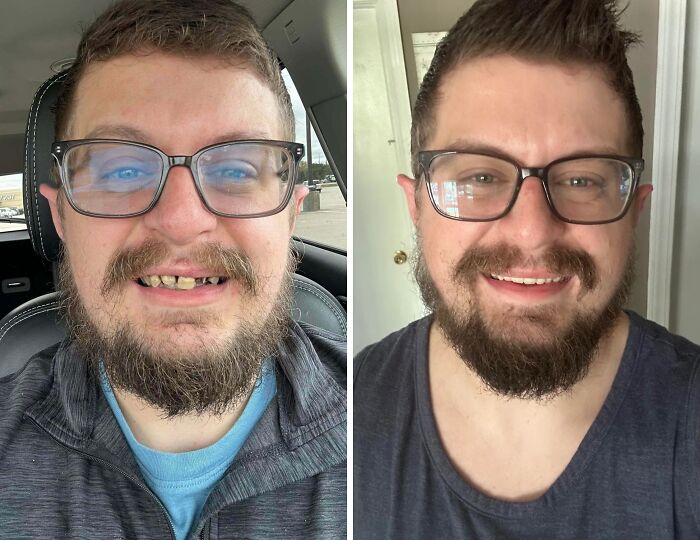 Man wearing glasses smiling in a before-and-after transformation showing a complete personal reinvention.