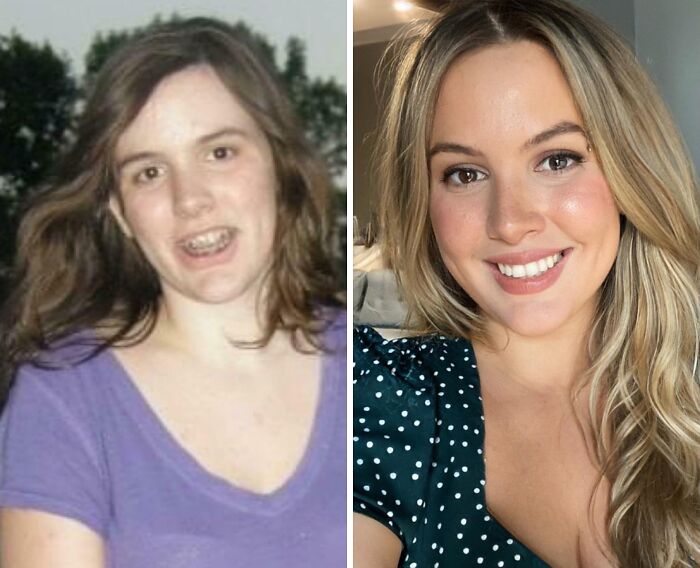 Side-by-side before and after photos showing stunning transformation and reinvention of a woman’s appearance.