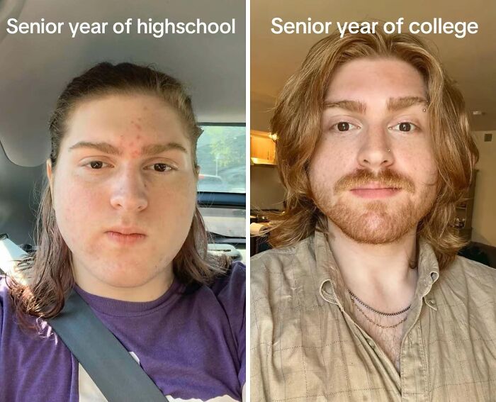Side-by-side before-and-after photos showing a stunning personal reinvention from senior year of high school to college.