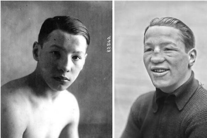 Black and white historical photos showing two unique young men with distinct facial features and hairstyles.