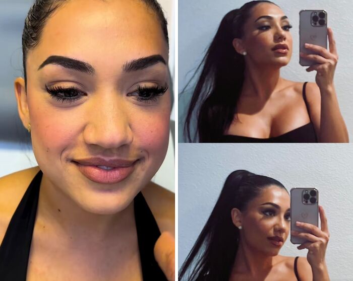 Before and after plastic surgery results shown in close-up and mirror selfie of a woman with styled hair and makeup.