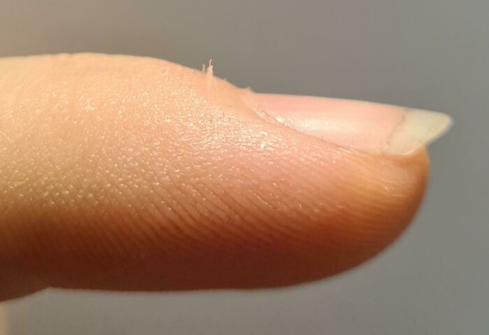 Close-up of a fingertip captured in a frozen frame showing skin texture and a small peeling cuticle edge.