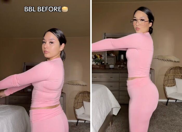 Woman showing before and after plastic surgery results of a Brazilian B**t Lift, wearing pink outfit in a bedroom setting.