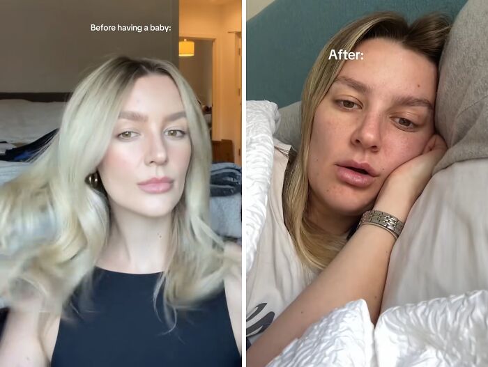 Side-by-side photos of a mom before and after having kids showing honest and relatable changes in appearance.