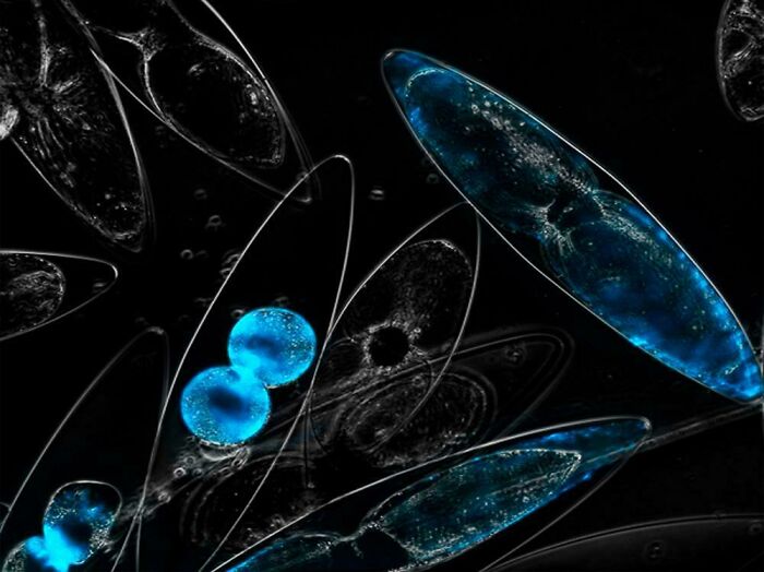 Microscopic view of aquatic microorganisms showcasing intricate animal structures in vibrant blue and black contrast.