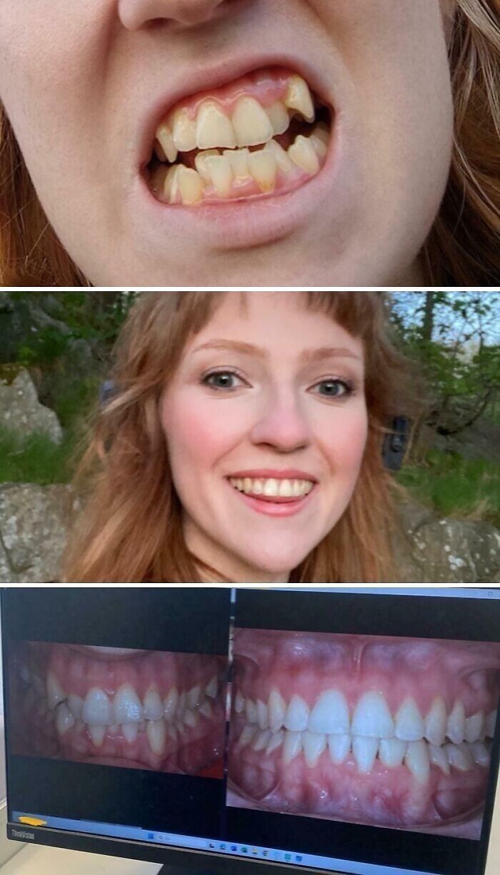 Before and after images showing a dental transformation, highlighting dreams turned into reality and inspiring smiles online.