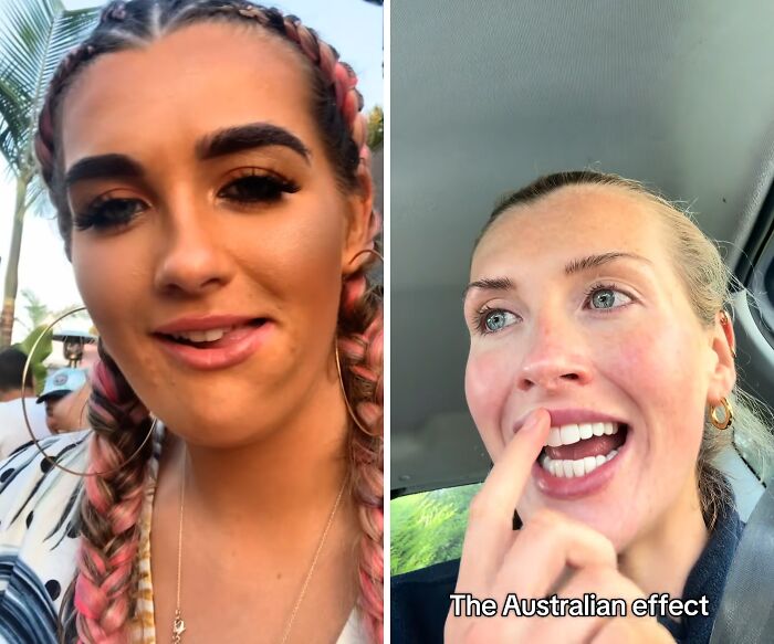 Side-by-side before and after photos illustrating the transformative Australian effect on people's appearances.