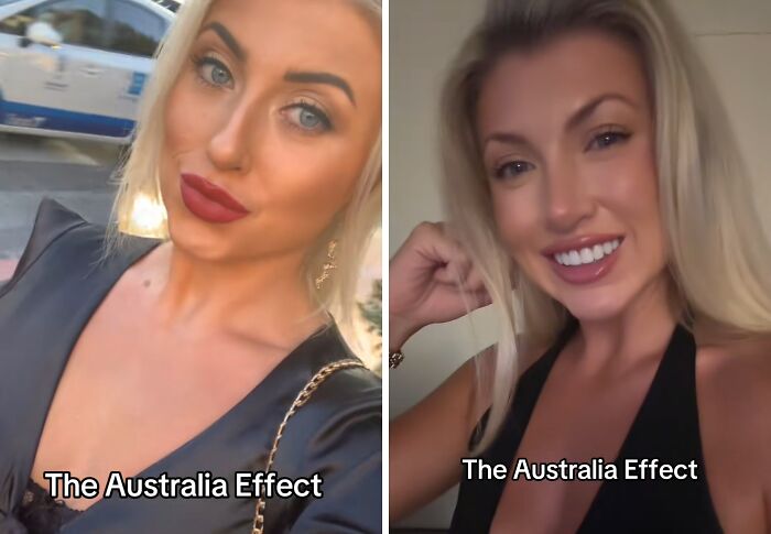 Side-by-side before and after photos showing the Australia effect on a smiling blonde woman’s appearance.