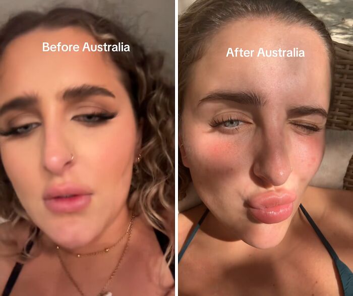 Side-by-side before and after pics showing a woman’s transformation with natural sunlight and relaxed expression in Australia.