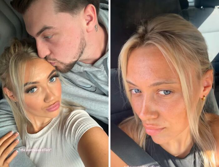 Before and after pics showing how Australia changes people with visible skin and lifestyle transformation in close-up selfies.