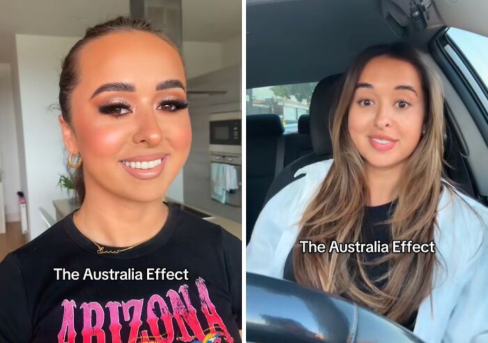 Side-by-side before and after photos illustrating the Australia effect on people's appearance and confidence.