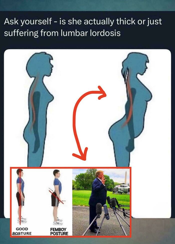 Illustration comparing lumbar lordosis posture to things that look like or remind people of other things with a humorous example.
