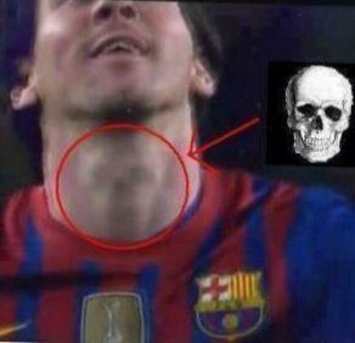 Close-up of a soccer player’s neck with a mark resembling a skull, illustrating things that remind people of other things.