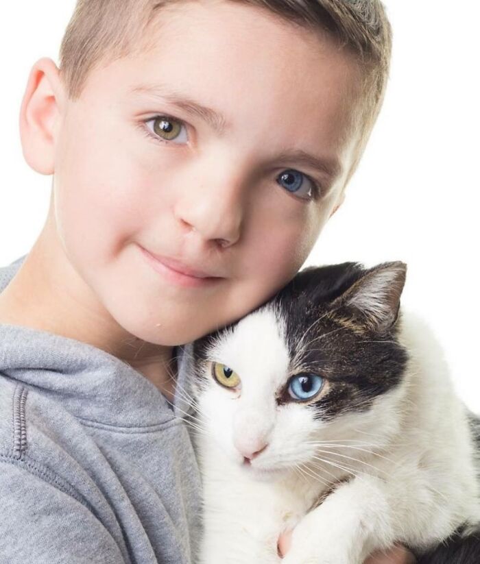 Boy and cat both with heterochromia, showing unique eye colors, highlighting fascinating photos from Spill Now.