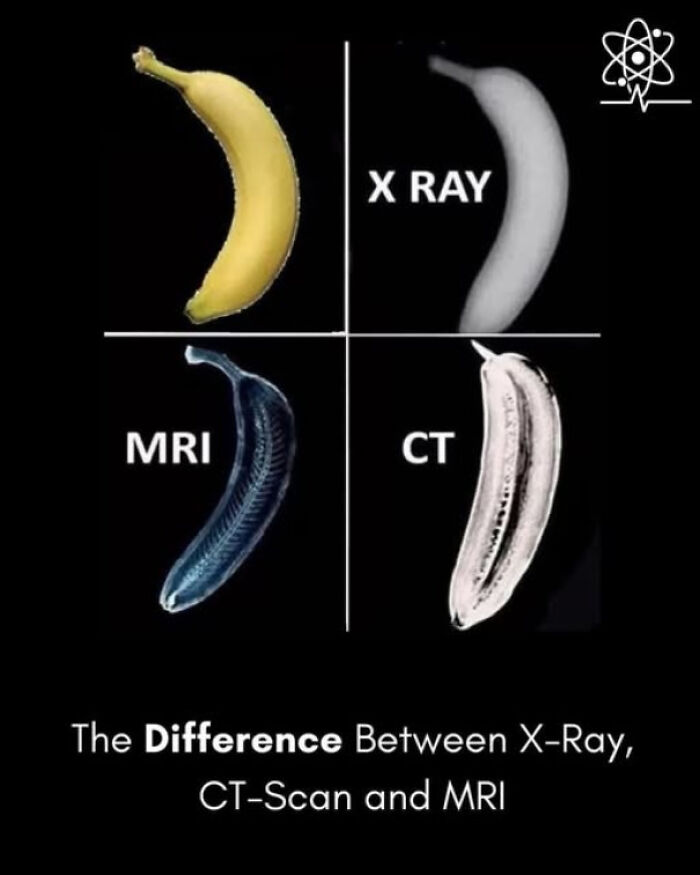 Banana shown with X-ray, CT scan, and MRI views, illustrating existence and reality through different imaging techniques.
