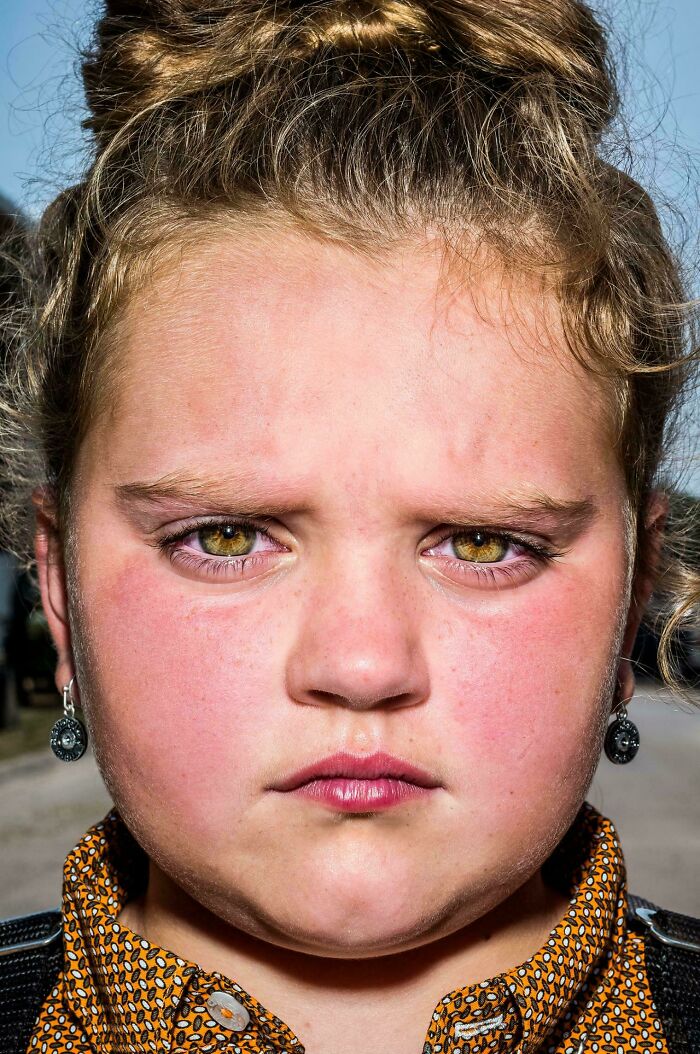 Close-up portrait of a young person showing the strength and beauty of overlooked human diversity.