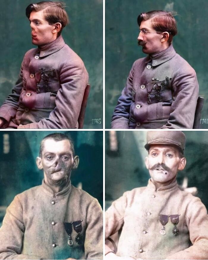 Before and after restoration photos of Victorian era soldiers with facial injuries showing the weird photos from the Victorian era.
