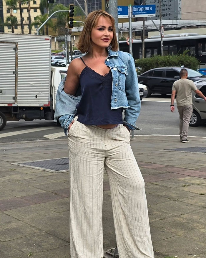 Actress posing outdoors wearing a denim jacket and striped pants, fans divided over plastic surgery clinic before-after pictures.