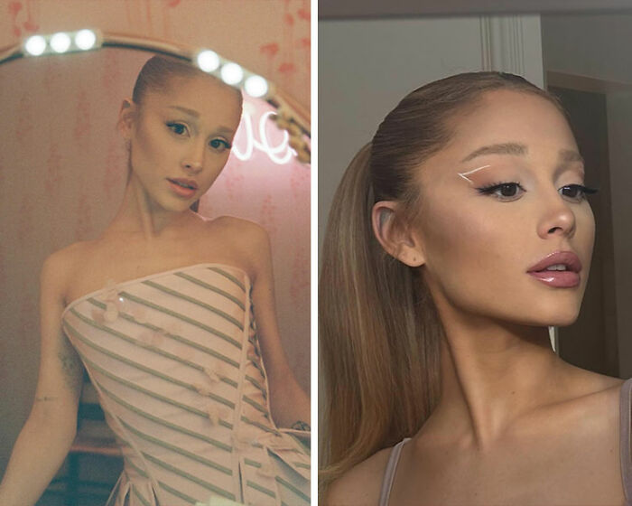 Before-and-after shots of Ariana Grande fuel fans speculating about her rhinoplasty plastic surgery results.