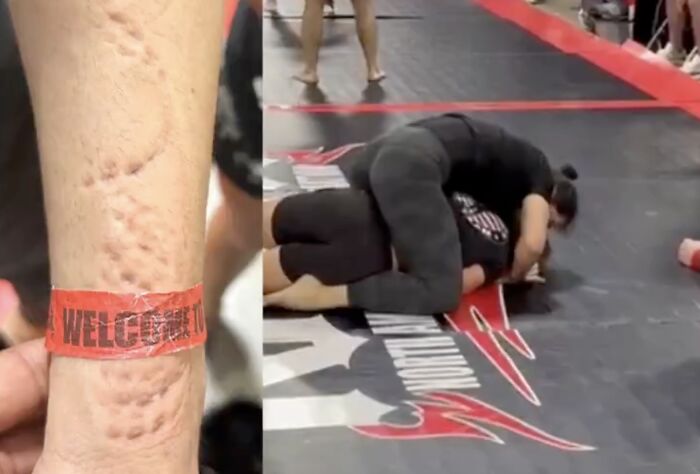 &ldquo;Completely Insane&rdquo;: Jiu-Jitsu Athlete Brutally Bitten By Opponent During Match In Viral Video