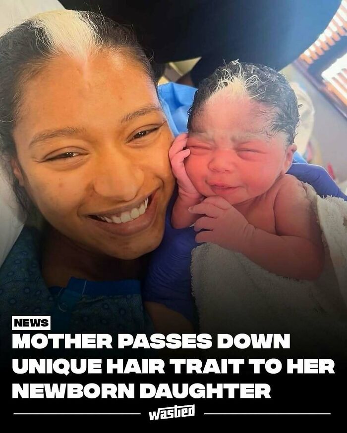 Mother and newborn daughter with unique matching hair traits, shared by 18.2M people who follow fun facts and new things pages.
