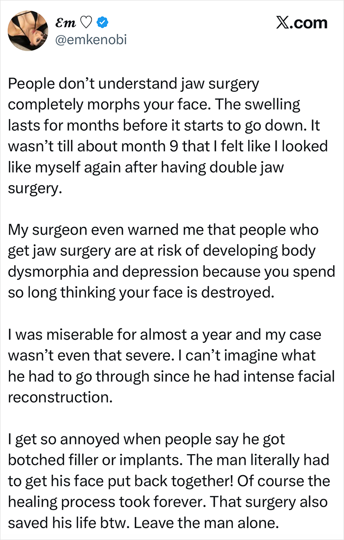 Zac Efron's 'Back to Normal' Face Has Everyone Talking As Expert Weighs In On What Happened