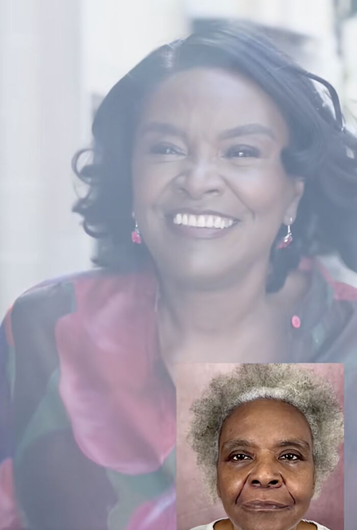 Before and after plastic surgery photos of a woman showcasing her transformation and results shared online.