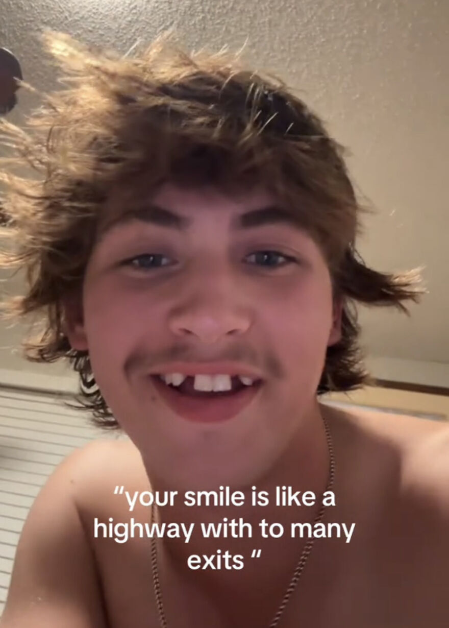 Young man with missing front teeth smiling, sharing perfect imperfections in a wholesome trending photo.