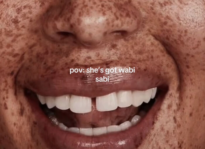 Primer plano de sonrisa con pecas celebrando lo que hace única a cada persona en fotos hermosas y auténticas.