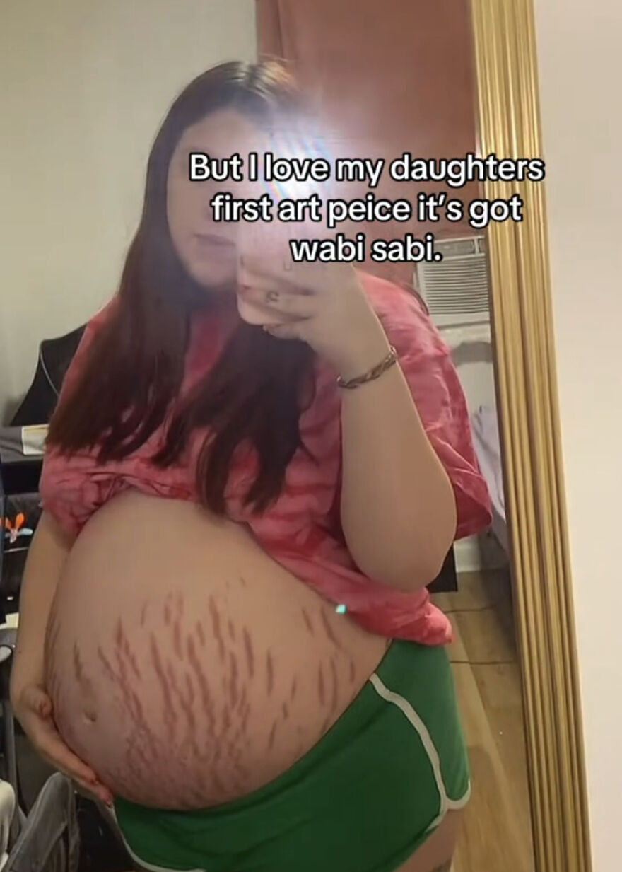 Pregnant woman showing stretch marks and sharing perfect imperfections reflecting a wholesome trend of self-acceptance.