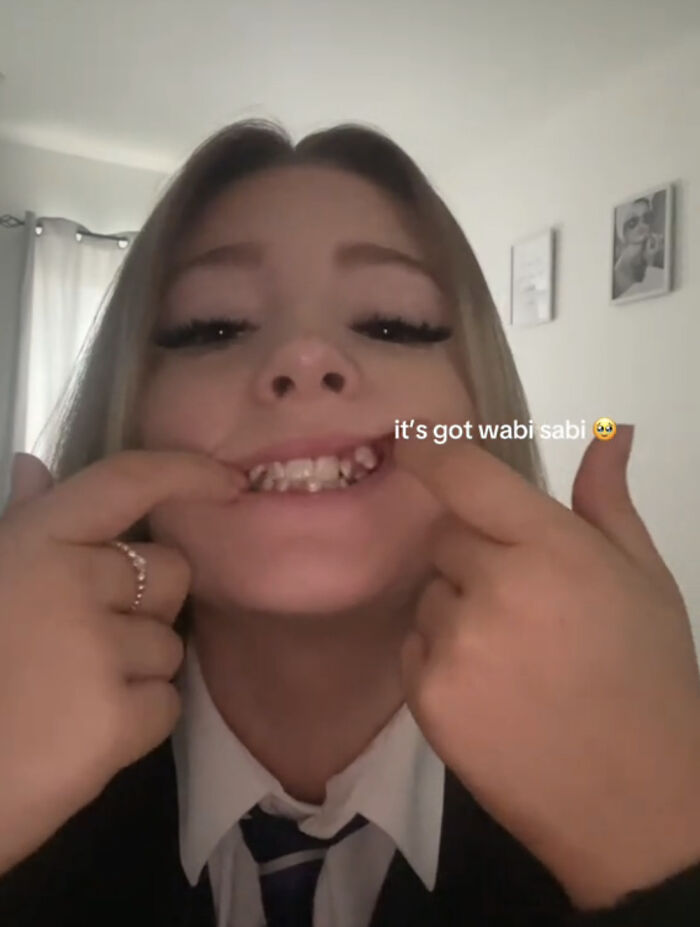 Joven sonriente mostrando sus dientes únicos celebrando lo que hace a cada persona especial y diferente.