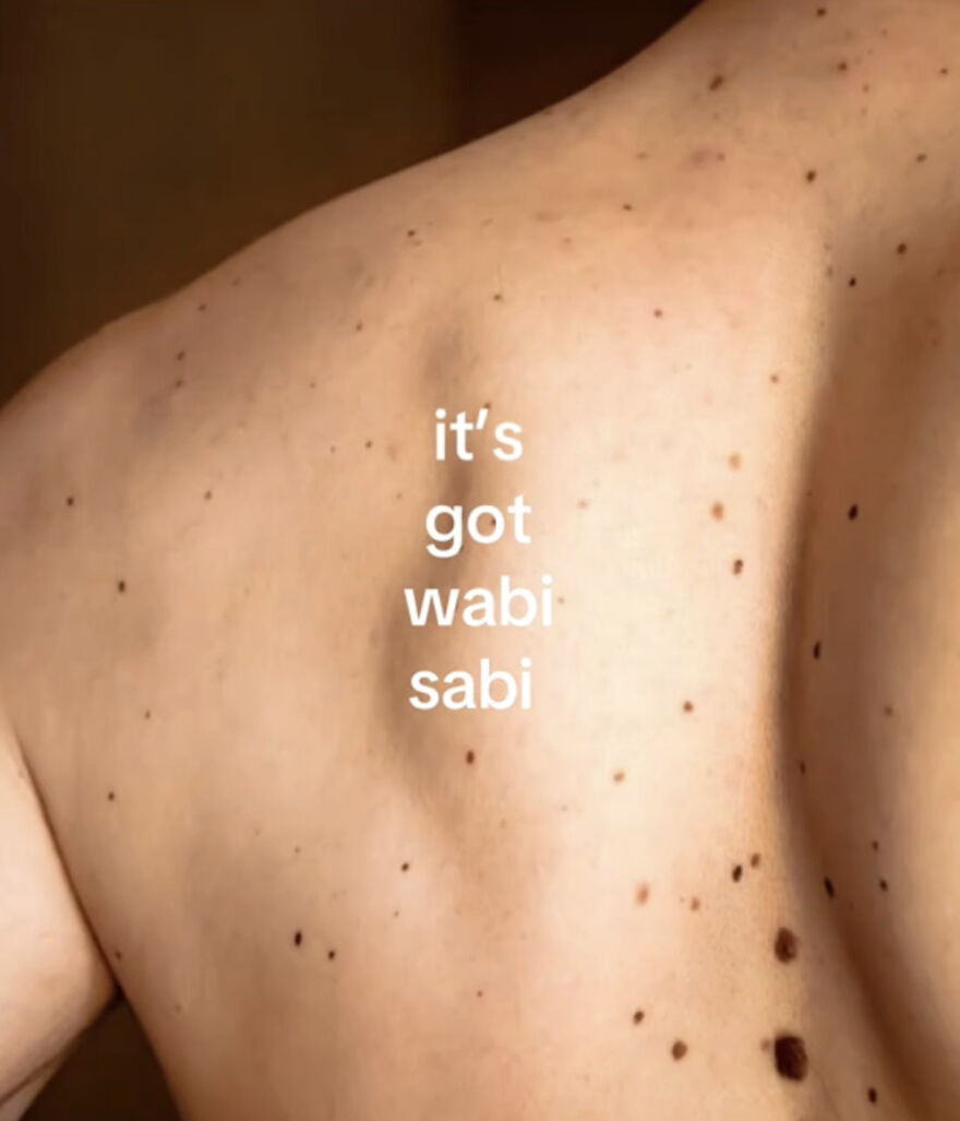 Close-up of a freckled back with text highlighting perfect imperfections and embracing natural beauty trends.