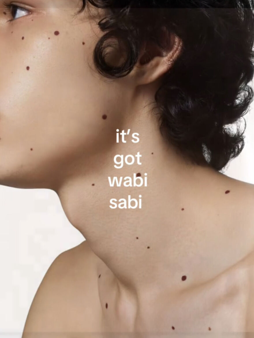 Close-up of a person’s neck and shoulder showing multiple moles, highlighting perfect imperfections and natural beauty.