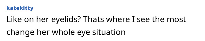 Fan comment discussing noticeable changes around Ariana Grande&rsquo;s eyelids suggesting specific type of plastic surgery.