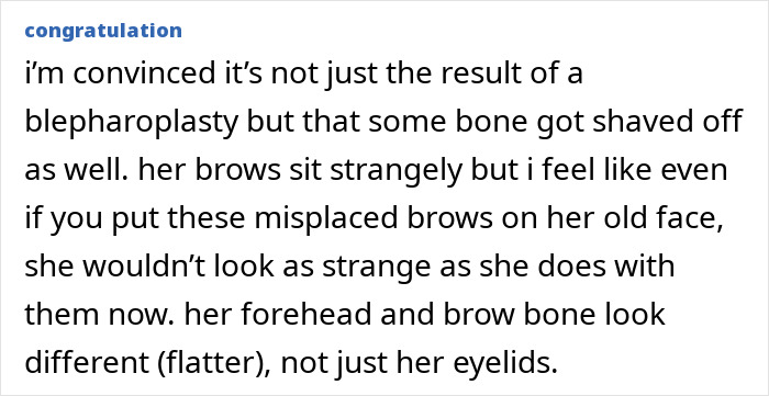 Comment discussing Ariana Grande&rsquo;s possible blepharoplasty and bone shaving plastic surgery with altered brow and forehead appearance.