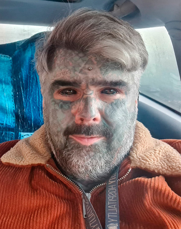 Man with extensive face tattoos and blacked-out eyeballs sitting inside a car revealing the dangerous tattoo process. Man with extensive face tattoos and blacked-out eyeballs sitting inside a car revealing the dangerous tattoo process.